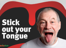 tongue diagnosis tcm