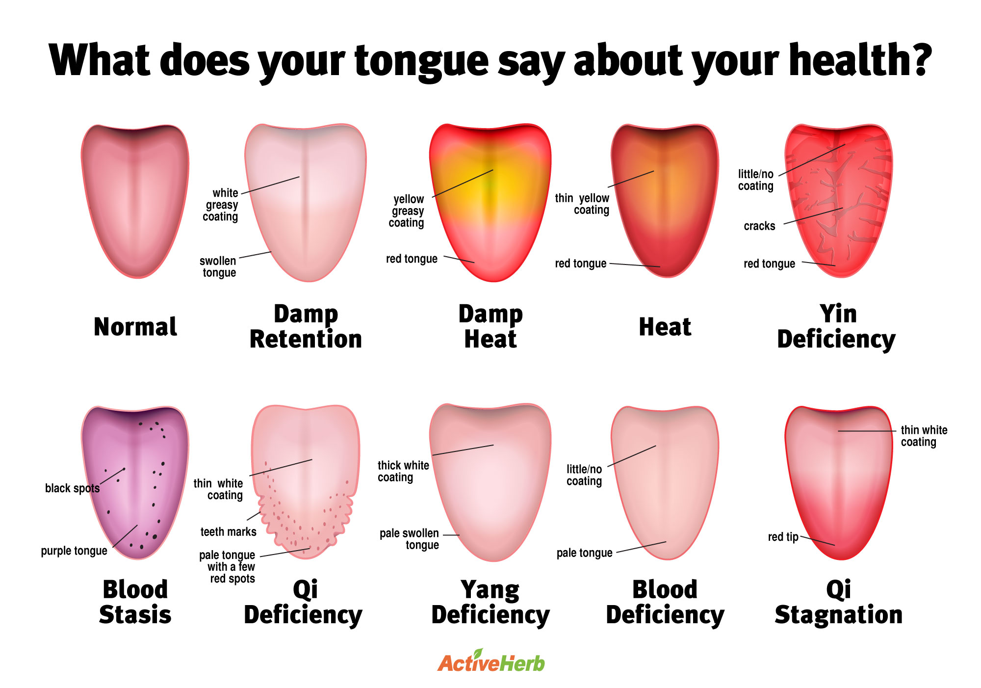 normal tongue coating