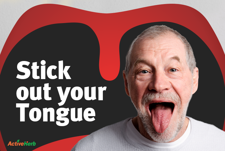 tongue diagnosis tcm
